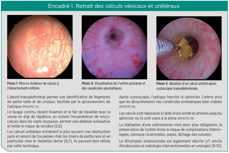 Encadré 1: retrait des calculs vésicaux et urétéraux